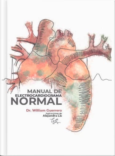 Portada Manual Electrocardiograma Dr William Guerrero